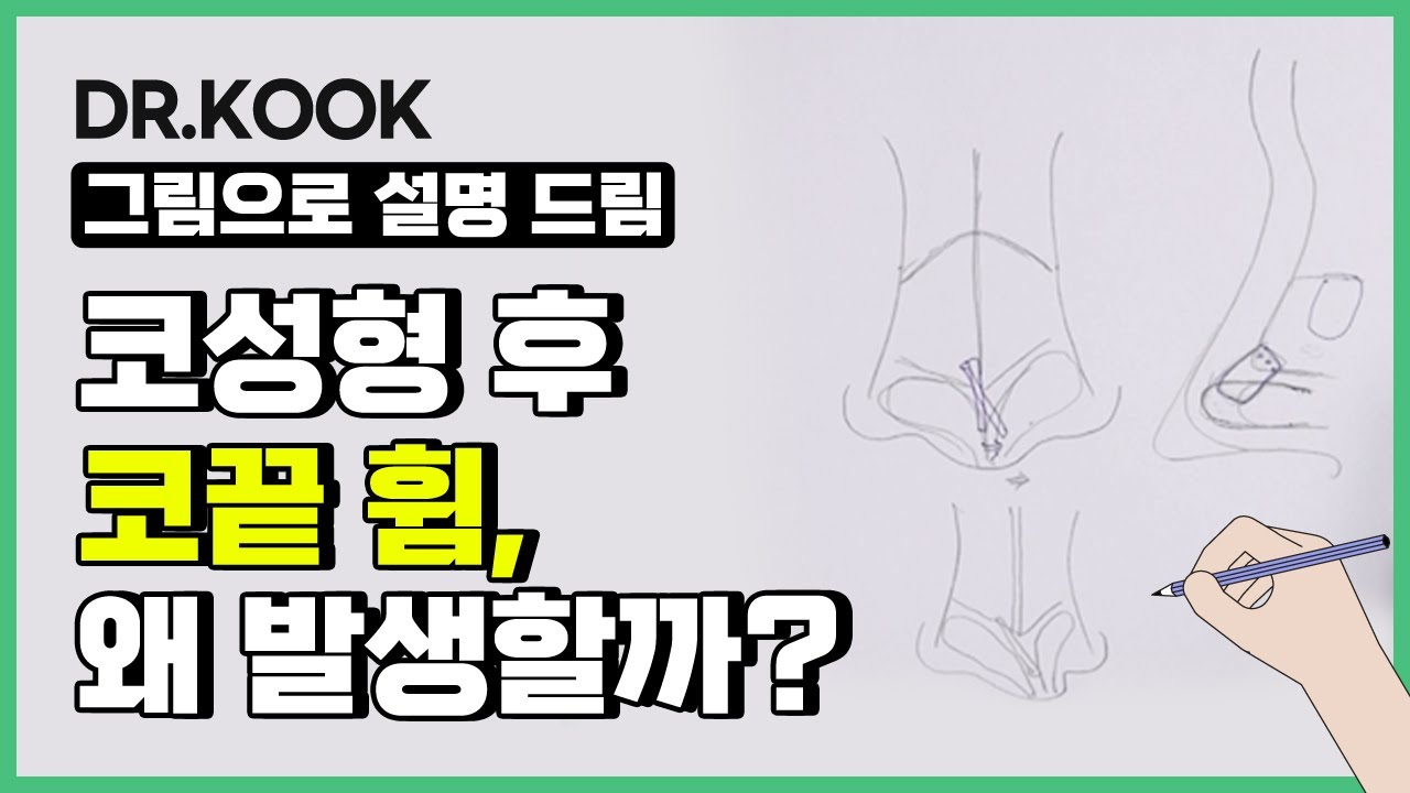 [그림설명] 코 성형 후 생기는 코끝변형 왜 발생할까?! 썸네일