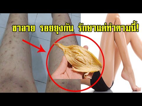 เพิ่มหน้าอกกับยี่หร่า การเยียวยาชาวบ้านเพิ่มหน้าอก