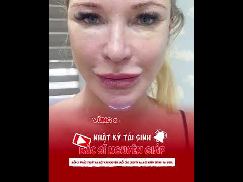 Rebirth Diary - Episode 3: The Journey to Reclaim Youth in Vietnam for an Australian Client