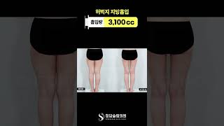 붙던 하체 라인 사라짐… 한달차 변화 👖