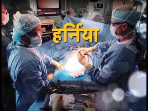 स्वस्थ किसान - लापरवाही से गंभीर हो सकता है हर्निया का मर्ज़-बचाव और उपचार