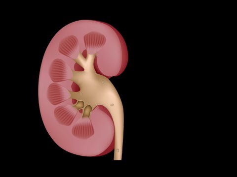 Urology Month: Am I Passing a Kidney Stone?