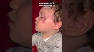 Baby falls down the stairs #baby #momlife #sahm #babyboy #youtube #shorts #youtubeshorts