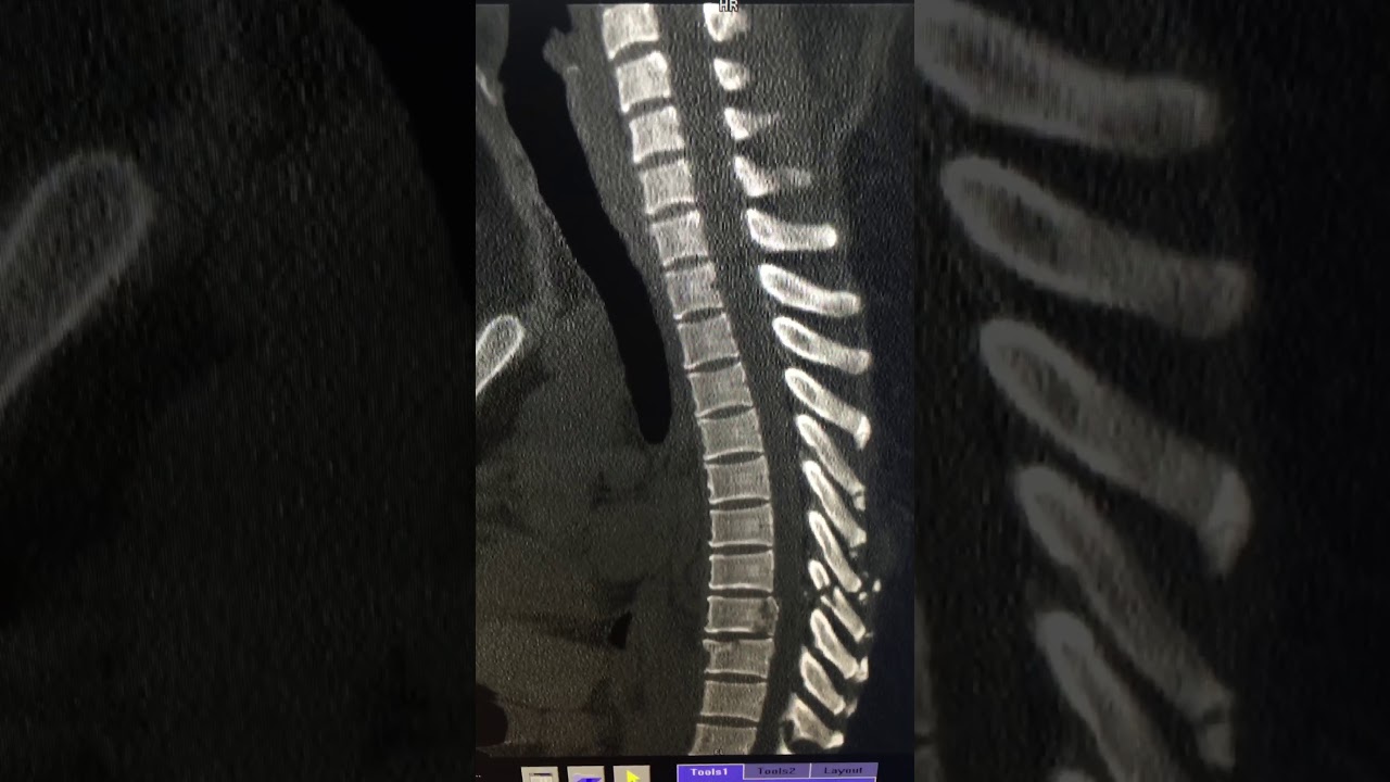 Griselda Collado Arce-42