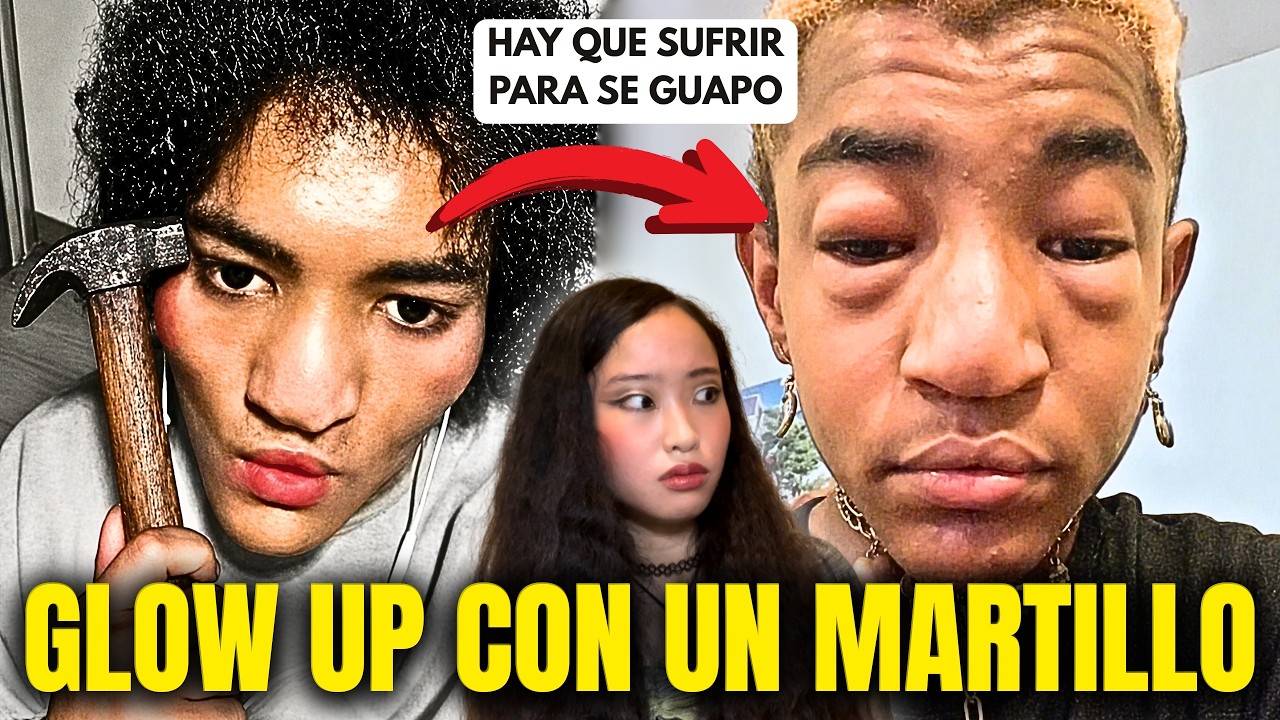 Arruinó Su Cara con un Martillo… Y Ahora VENDE un Curso Para Que Hagas Lo Mismo