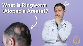 What is Ringworm (Alopecia Areata)? - Hair Center Of Turkey