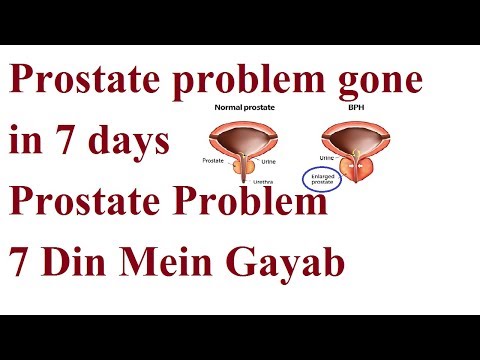 Massage der Prostata bei Männern Bietet Behinderung, ob in der Prostata