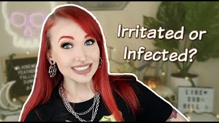 Is Your Piercing INFECTED or IRRITATED?