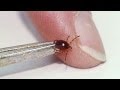 LYME DISEASE Is Spreading - YouTube