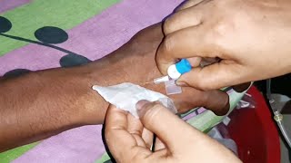 Download lagu Cannula,  Saline খোলার নিয়ম। Cannula Removing Video. mp3