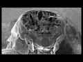 See Inside Insects With An Electron Microscope And A Femtosecond Laser
