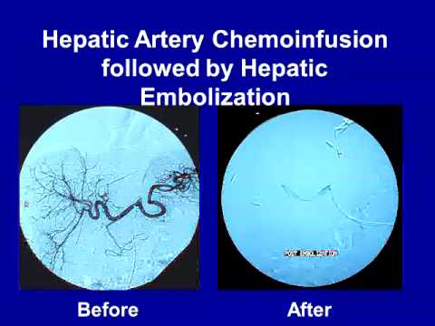 Interventional Radiology as the Fourth Discipline of On