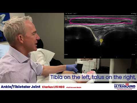 Intra-articular tibiotalar injection demonstration