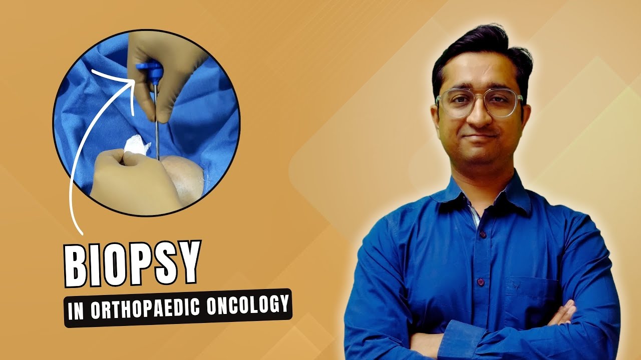 Biopsy in Orthpaedic Oncology