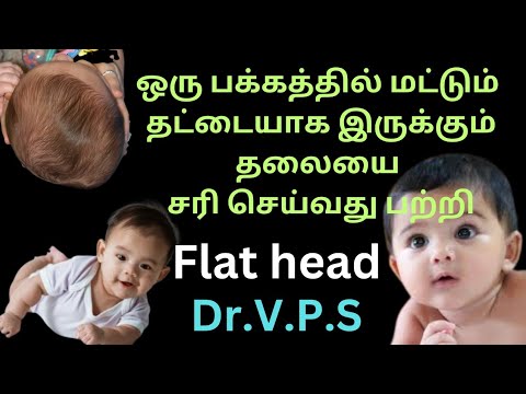 #How to change the shape of a baby's head to make it flathead | #newborn #newbornbaby #tamil