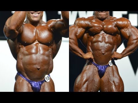 download lagu mp3 mp4 Phil Heath Surgery, download lagu Phil Heath Surgery gratis, unduh video klip Download Phil Heath Surgery Mp3 dan Mp4 Music Gratis