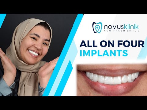 Logo of Pain-Free Dental Implants – Cost, Global Clinics, and Patient Care in Istanbul, Turkey