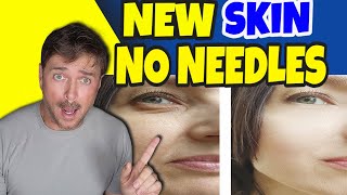 Get Much Younger Skin Without Needles! | Chris Gibson