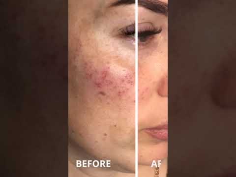 Phytobiotech Skin Repair Complex