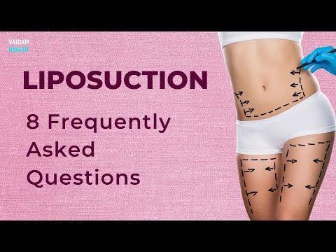 Liposuction - 8 Frequently Asked Questions