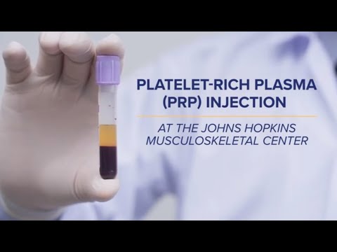 Platelet-Rich Plasma (PRP) Injections | Q&A