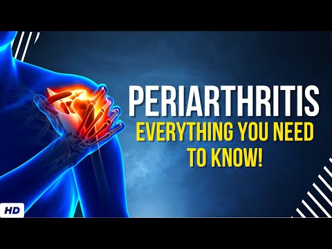 Frozen Shoulder Causes Signs and Symptoms Diagnosis and Treatment