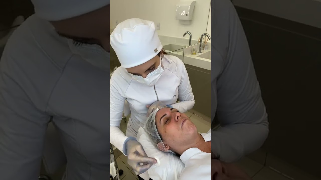 Microagulhamento Facial - Passo a Passo - Aula ao Vivo
