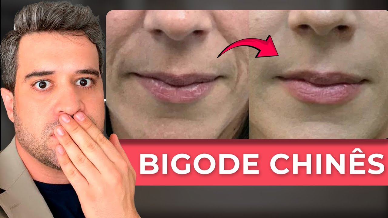 Óleo Tira Rugas e Bigode Chinês em 1 Noite