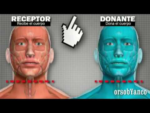 Come ringiovanire la pelle di faccia sottile I fili per sollevamento di faccia costati in SPb