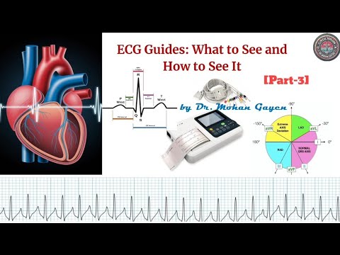 ECG series (Part-3) | How to calculate cardiac axis easily? | © Dr. Mohan Gayen