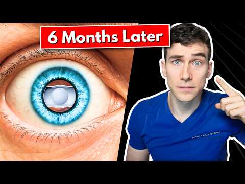 ICL Surgery 6-Month Update: The Good, The Bad, and the Unexpected