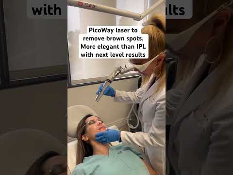 Removing brown spots #pico #laser #expert #shorts