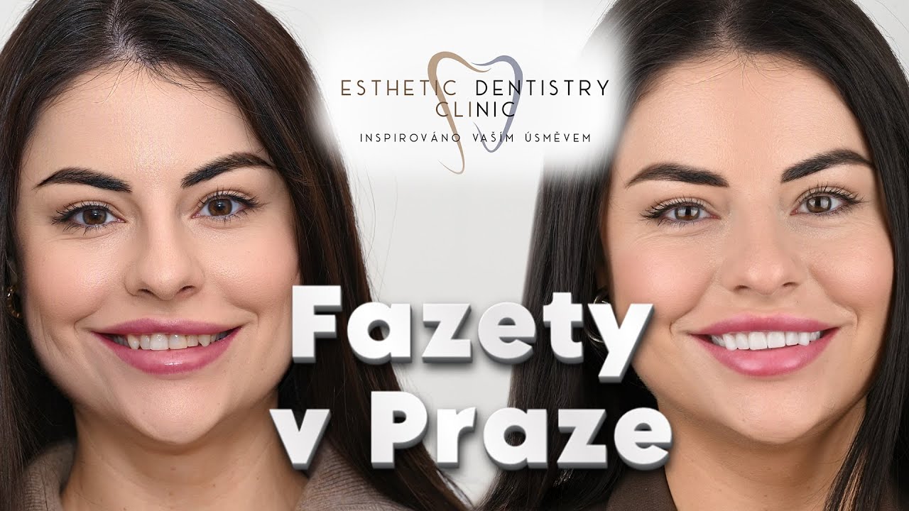 Můj příběh: cesta k sebevědomému úsměvu na klinice ED Clinic