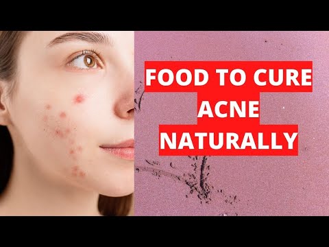 , title : 'Food To Cure Acne Naturally / Traditional Way To Get Rid Of Acne / Bestie Health'