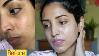 I Used RETINAL for 2 MONTHS and This Happened | For Clear Skin