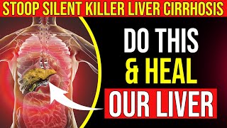 Silent Killer: How to Detect Liver Cirrhosis Before It's Too Late! Life-Saving Signs You Must Know!