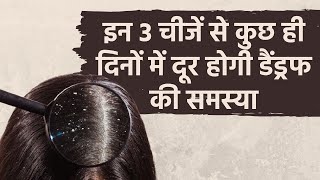 Dandruff problem in winter | सर्दियों में डैंड्रफ का रामबाण इलाज