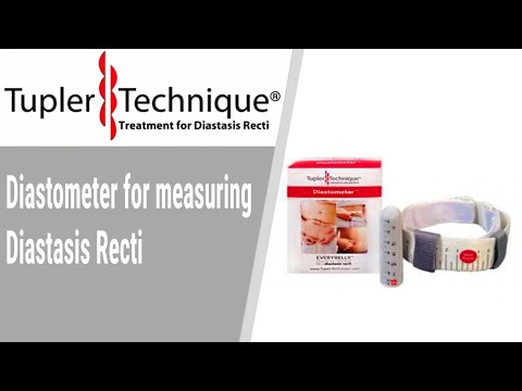 Diastometer for measuring Diastasis Recti