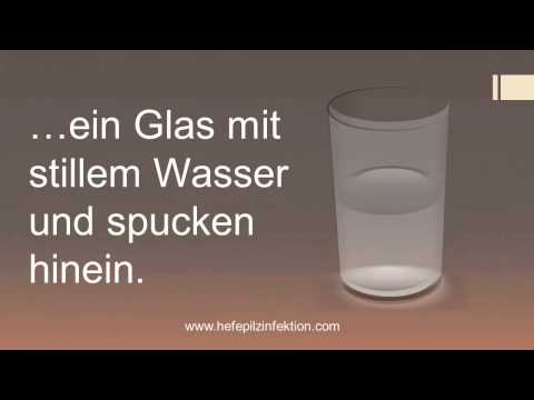 Gribok die Füsse das Symptom Das Haifischfett von gribka der Nägel