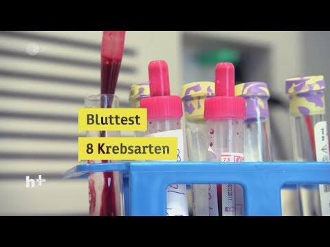Neue Pillen senken den Blutzucker Wie man tötet das Insulin