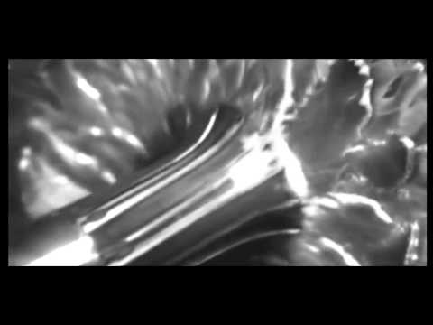 Technical Itch - Live @ BBC Peel Sessions [2002] HQ HD