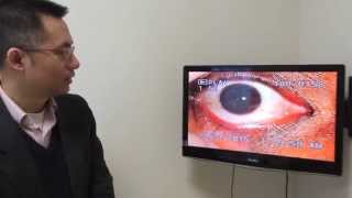 Optic nerve atrophy ? how to diagnose the illness ? and the treatment. Part 1