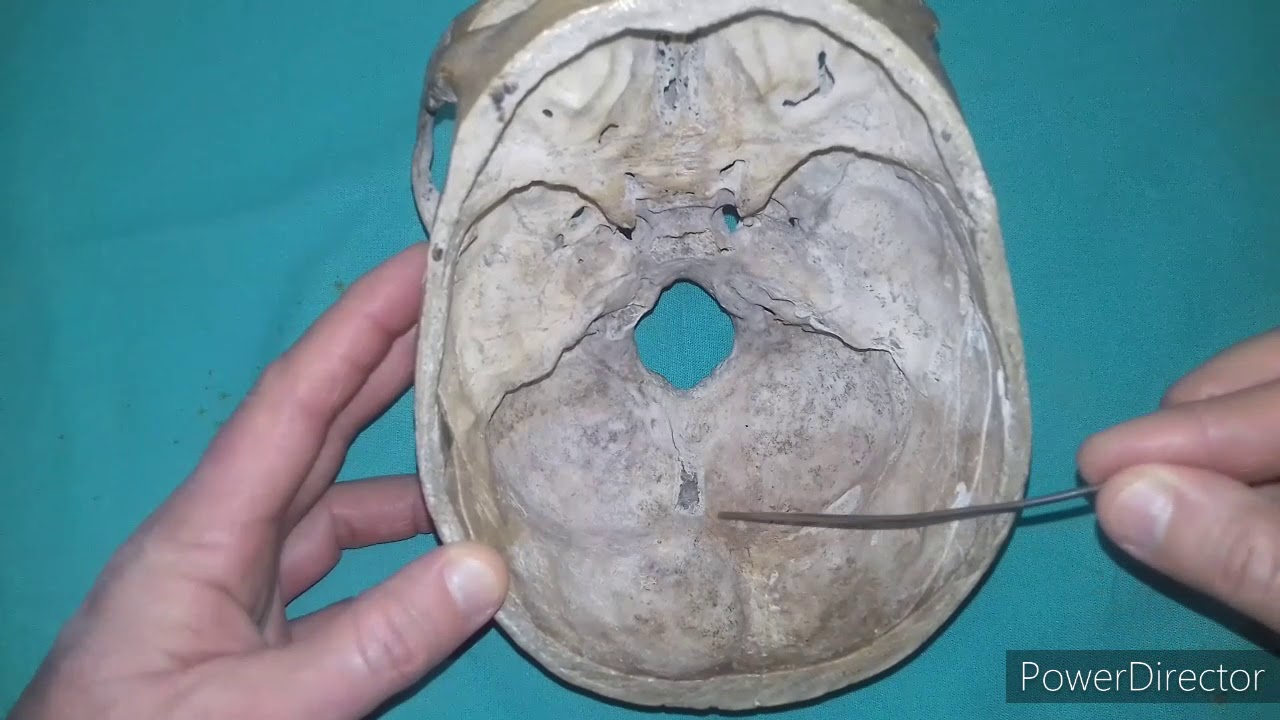 TP N° 21 Cráneo y cara en general  Hioides  Articulaciones de la cabeza  Dr  Luciano Esborrat