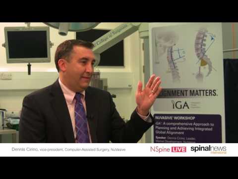 Dennis Cirino: Achieving alignment beyond preoperative planning