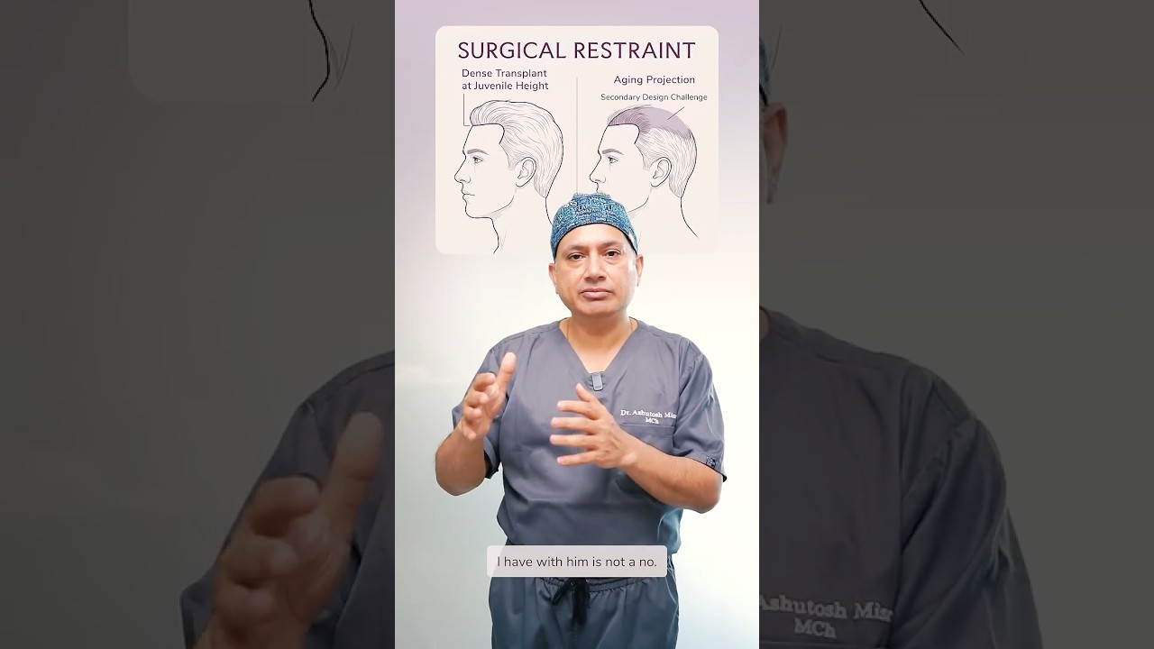 Hair Transplant: Why Surgical Restraint Matters