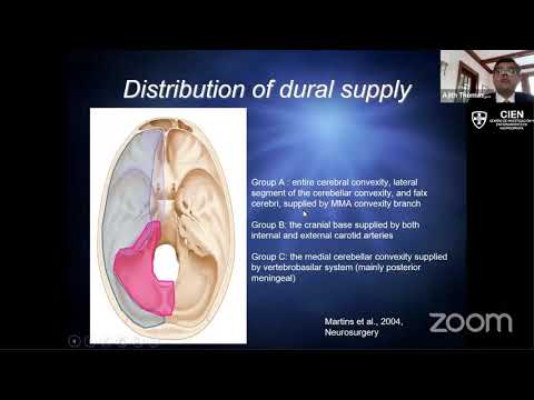 27. Evaluation and Management of Dural Arteriovenous Fistulas by Dr. Ajith Thomas