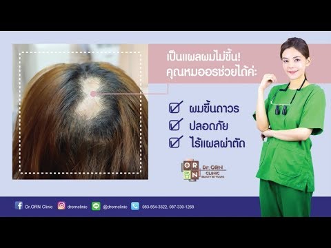 สิ่งที่ยาเสพติดในการรักษา neurodermatitis ครีม petrolatum celandine ในโรคสะเก็ดเงิน