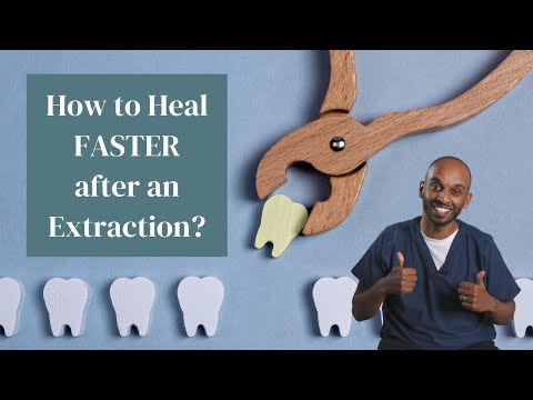 How to heal FASTER after an extraction? - TEN Top Tips