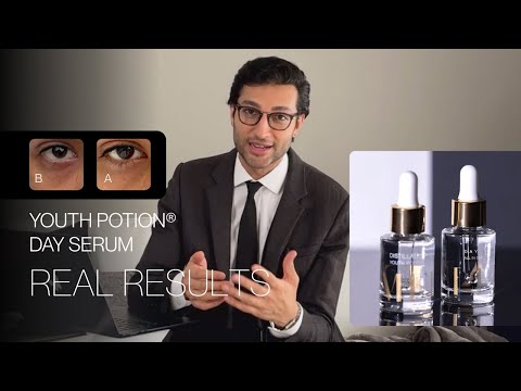 Under-Eye Brightness in 10 Days: Real Results with AMELLE's Brightening Day Serum