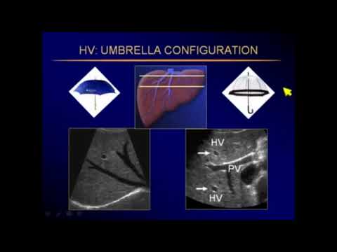 Ultrasound Abdominal pathology